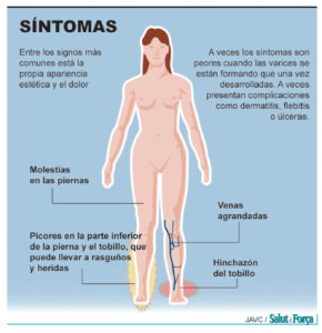 Sheynyy el departamento de la columna vertebral la estructura y las funciones