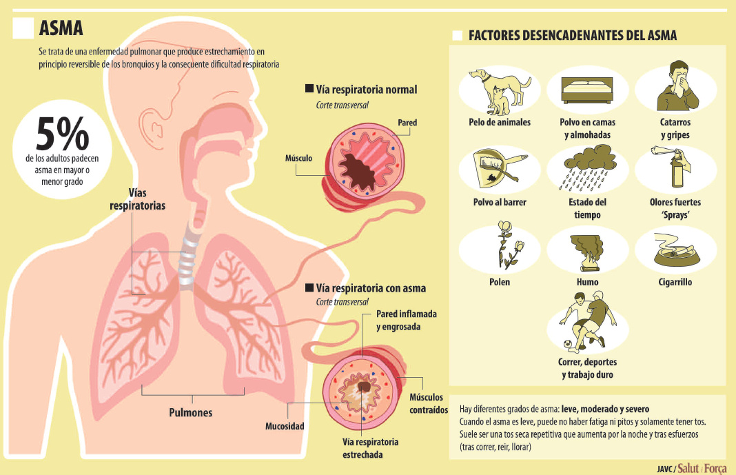asma-infantil-2