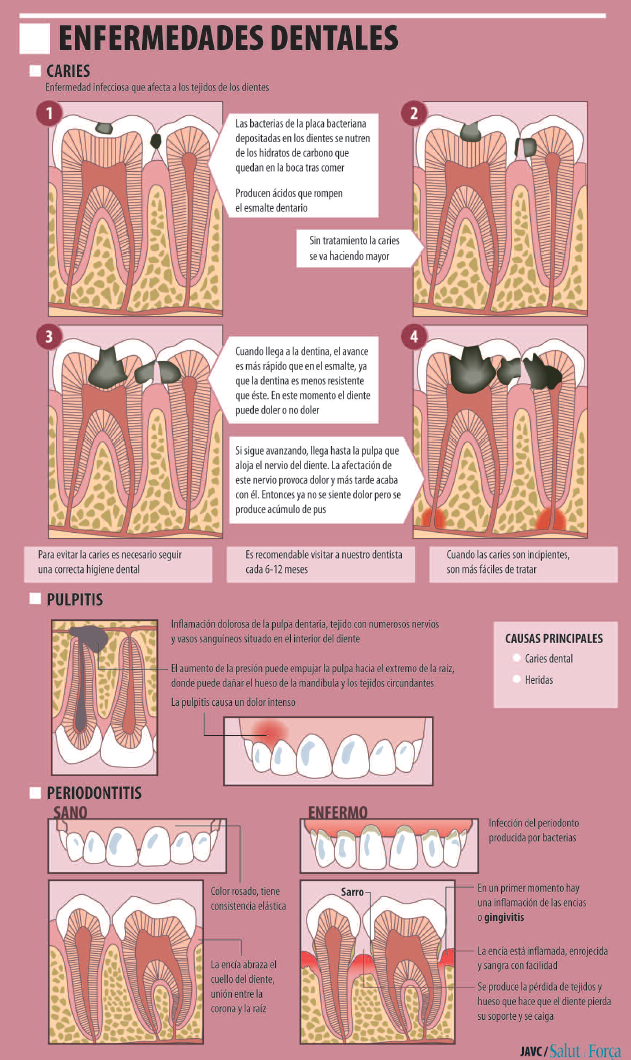 enfermedades-dentales