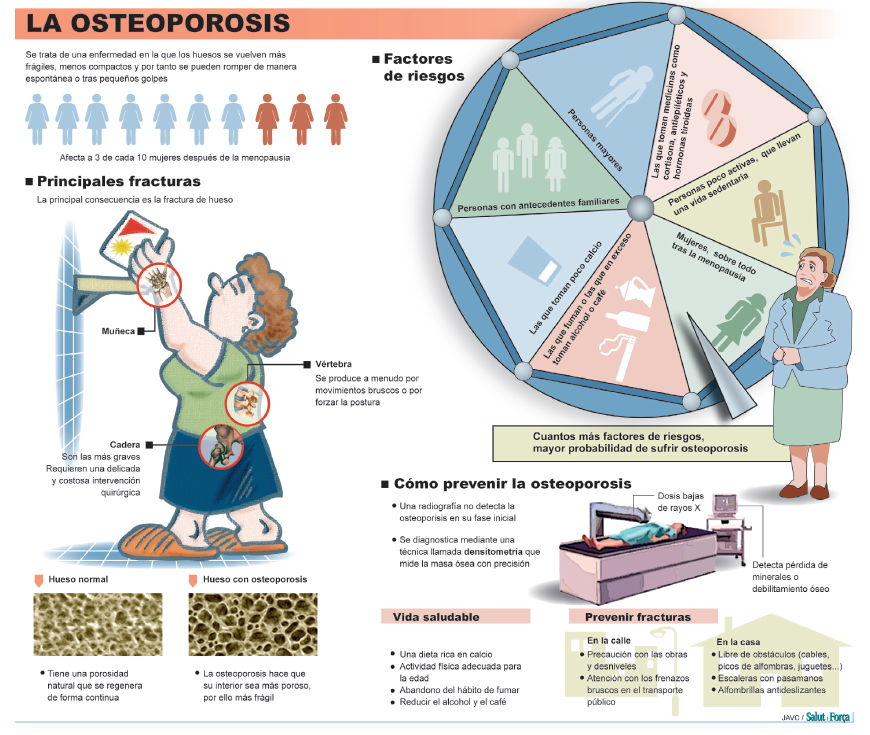 osteorporosis