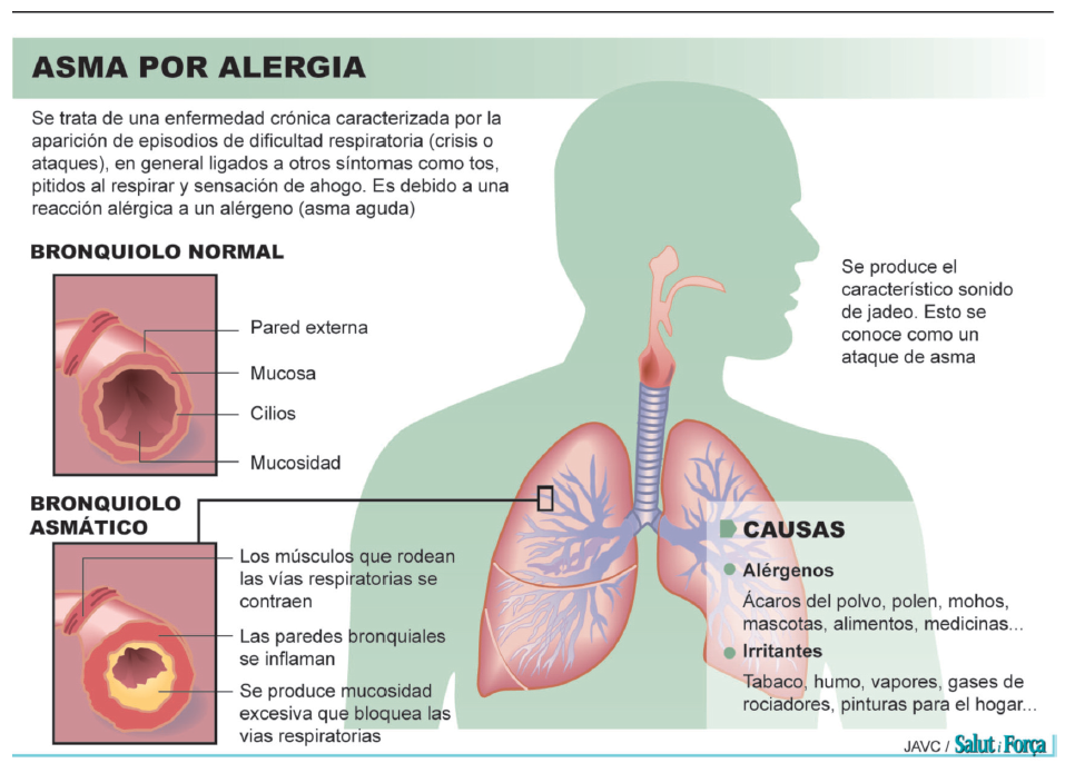 alergia-2