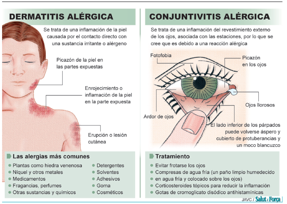 alergia-3