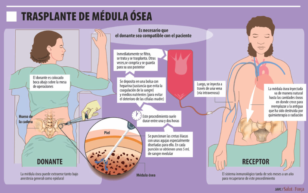 Trasplante de médula ósea Salud Ediciones