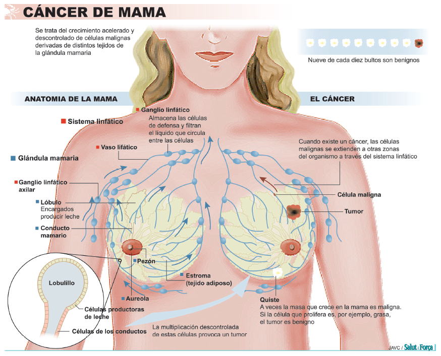cancer-mama-1