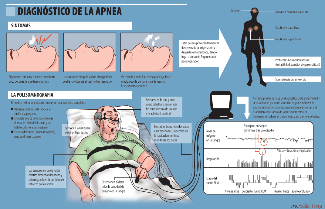 A los pacientes con apnea les dan una máquina y les dicen que su enfermedad  no tiene cura, pero no es verdad