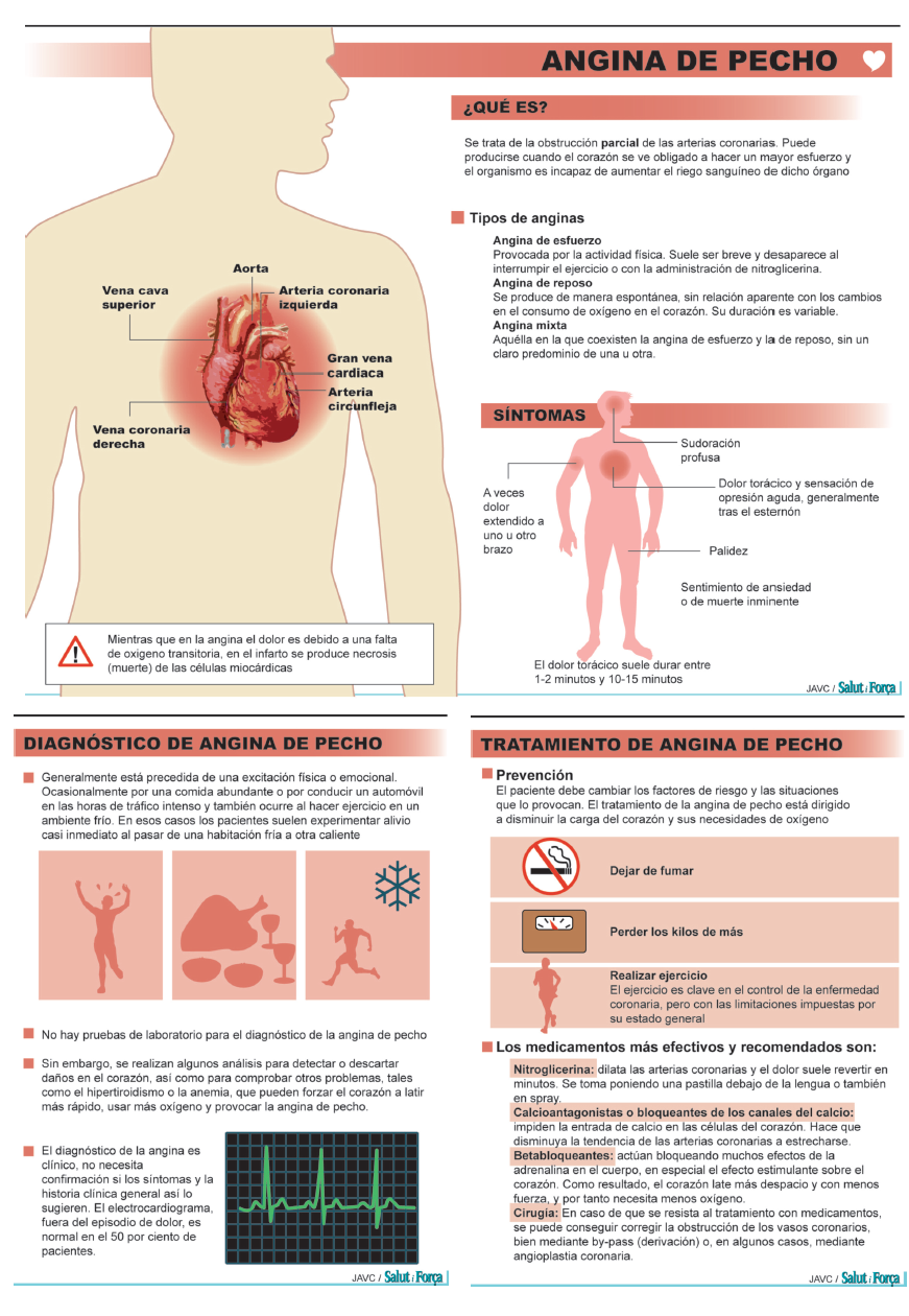 angina-de-pecho