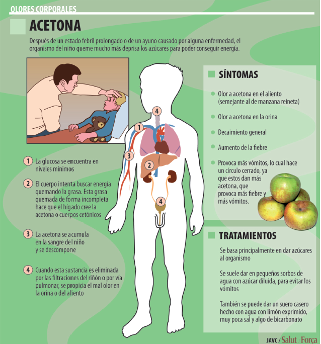acetona