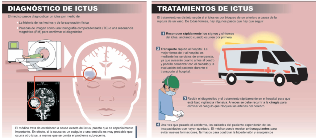 ictus-diagnostico-tratamiento