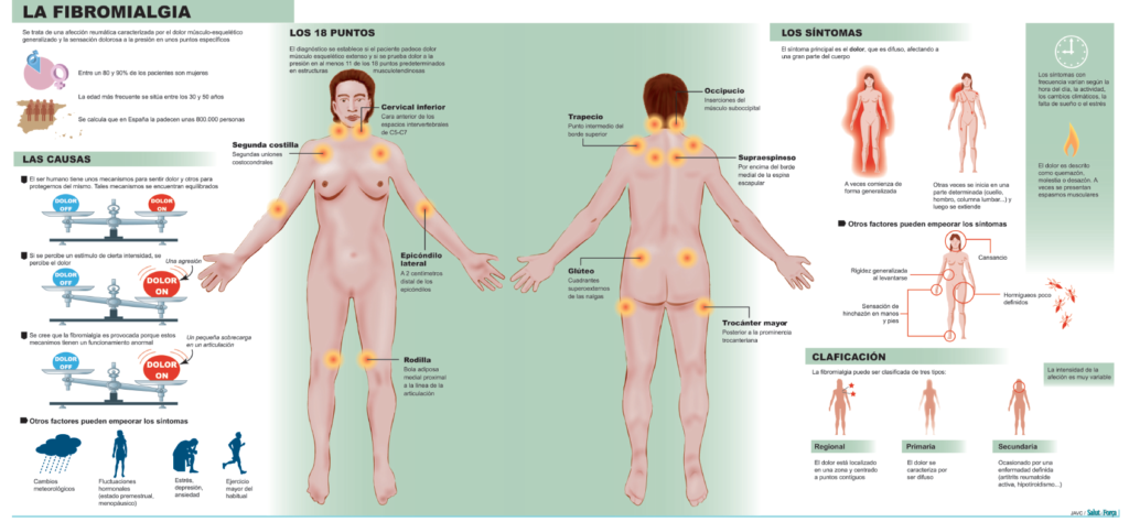 Sintomas del apendicitis en mujeres Sintomas del apendicitis en mujeres