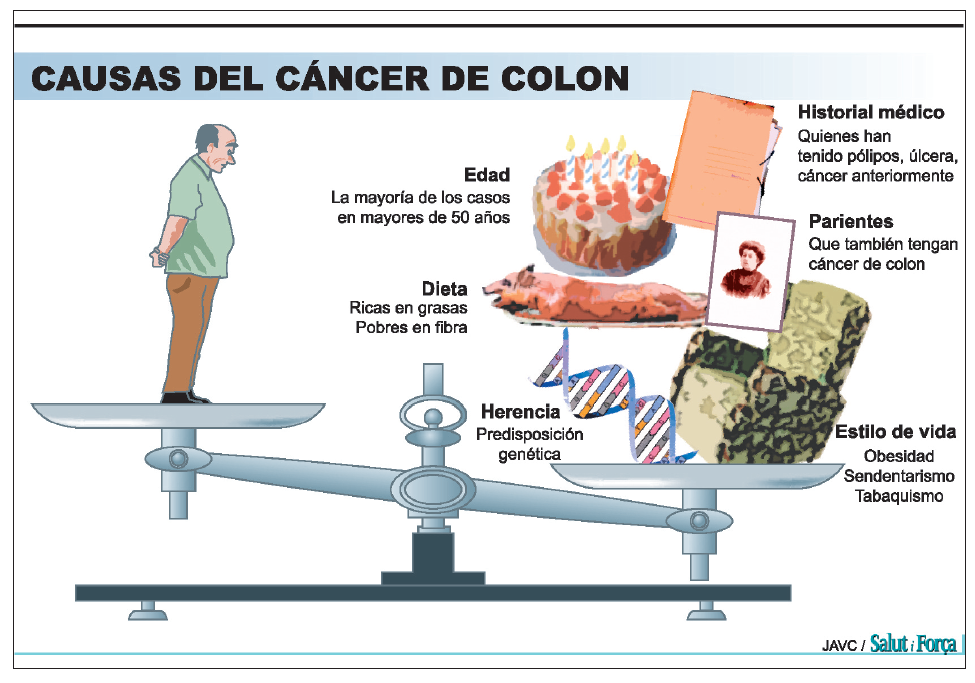 Como evitar cancer de colon