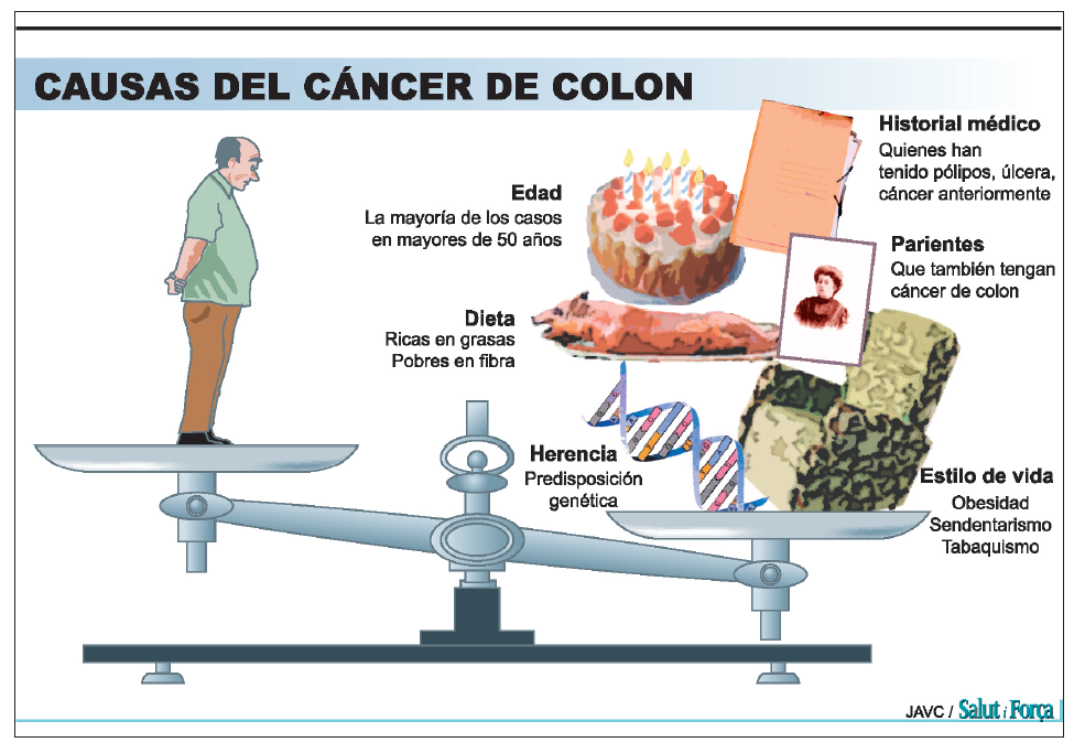 Dieta para personas operadas de cancer de colon